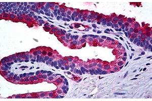Human Prostate: Formalin-Fixed, Paraffin-Embedded (FFPE)