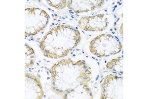 Immunohistochemistry of paraffin-embedded human stomach using PCDHA12 antibody at dilution of 1:100 (x40 lens). (PCDHA12 anticorps)