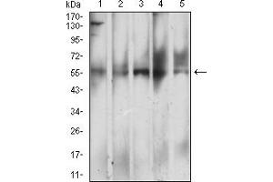 Western blot analysis using CD299 mouse mAb against L-02 (1), HepG2 (2), BEL-7402 (3), SMMC-7702 (4), and HL-7702 (5) cell lysate.