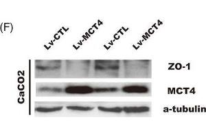 MCT4 destroys epithelial barrier function and inhibits ZO-1 expression. (TJP1 anticorps  (AA 1600-1700))