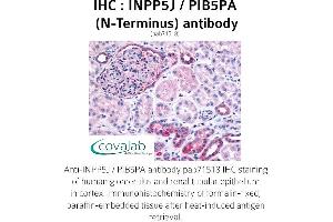 Image no. 1 for anti-Inositol Polyphosphate-5-Phosphatase J (INPP5J) (N-Term) antibody (ABIN1735940) (INPP5J anticorps  (N-Term))