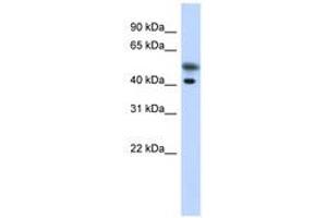 Image no. 1 for anti-Tropomodulin 2 (TMOD2) (N-Term) antibody (ABIN6741280) (TMOD2 anticorps  (N-Term))