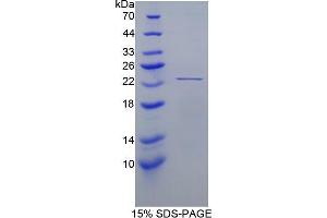 SDS-PAGE (SDS) image for Peroxiredoxin 1 (PRDX1) (AA 1-199) protein (His tag) (ABIN1099367)