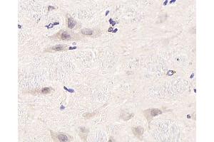 Immunohistochemistry analysis of paraffin-embedded rat brain using CDC25A Polyclonal Antibody at dilution of 1:1000. (CDC25A anticorps)