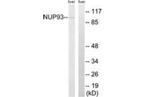 Western blot analysis of extracts from rat liver cells, using NUP93 Antibody. (NUP93 anticorps  (AA 221-270))