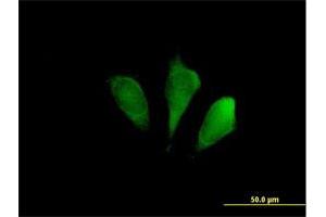 Immunofluorescence of purified MaxPab antibody to FBXO9 on HeLa cell. (FBXO9 anticorps  (AA 1-437))