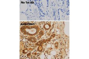 Immunohistochemistry (IHC) image for anti-Cadherin 1, Type 1, E-Cadherin (Epithelial) (CDH1) antibody (ABIN6254215)