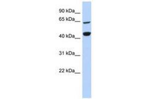 Image no. 1 for anti-Replication Factor C (Activator 1) 4, 37kDa (RFC4) (AA 287-336) antibody (ABIN6740953) (RFC4 anticorps  (AA 287-336))
