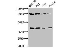 Western Blot Positive WB detected in: HEK293 whole cell lysate, PC-3 whole cell lysate, U87 whole cell lysate, Rat brain tissue All lanes: TRIM54 antibody at 3 μg/mL Secondary Goat polyclonal to rabbit IgG at 1/50000 dilution Predicted band size: 41, 45 kDa Observed band size: 41, 90 kDa (TRIM54 anticorps  (AA 60-358))