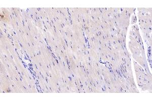 Detection of IL6 in Rabbit Cardiac Muscle Tissue using Monoclonal Antibody to Interleukin 6 (IL6)