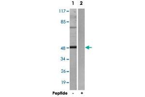 Western blot analysis of extracts from HepG2 cells, using ADRB2 polyclonal antibody . (beta 2 Adrenergic Receptor anticorps)
