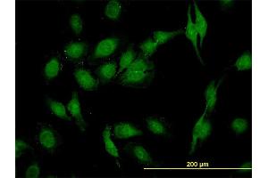 Immunofluorescence of monoclonal antibody to SEC22L1 on HeLa cell.