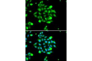 Immunofluorescence analysis of U2OS cells using UBE2G1 antibody (ABIN5974208). (UBE2G1 anticorps)