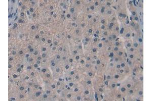IHC-P analysis of Human Liver Tissue, with DAB staining. (SPRY3 anticorps  (AA 91-288))