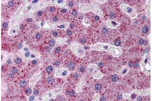 Human Liver: Formalin-Fixed, Paraffin-Embedded (FFPE)