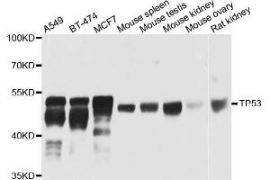 Western blot analysis of extracts of various cells, using TP53 antibody.