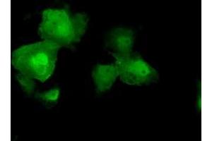 Image no. 7 for anti-V-Akt Murine Thymoma Viral Oncogene Homolog 2 (AKT2) antibody (ABIN1496564) (AKT2 anticorps)
