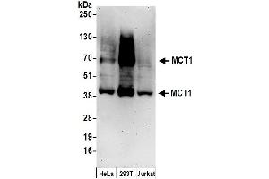 Western Blotting (WB) image for anti-Solute Carrier Family 16, Member 1 (Monocarboxylic Acid Transporter 1) (SLC16A1) (AA 450-500) antibody (ABIN7455025)