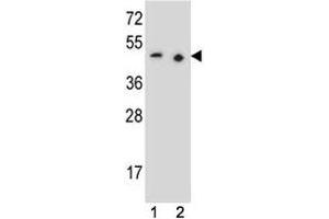 PAX9 antibody western blot analysis in (1) 293 and (2) Jurkat lysate (PAX9 anticorps  (AA 69-95))
