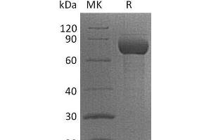 Western Blotting (WB) image for CD38 protein (Fc Tag) (ABIN7320968)