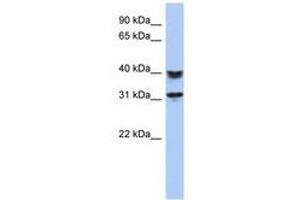 Image no. 1 for anti-Chromosome 5 Open Reading Frame 35 (C5orf35) (AA 71-120) antibody (ABIN6741237) (C5orf35 anticorps  (AA 71-120))