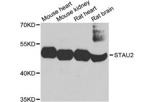 Western blot analysis of extracts of various cell lines, using STAU2 antibody. (Double-stranded RNA-binding protein Staufen homolog 2 (STAU2) anticorps)