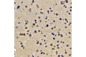 Immunohistochemical analysis of Lamin B2 staining in rat brain formalin fixed paraffin embedded tissue section. (Lamin B2 anticorps)
