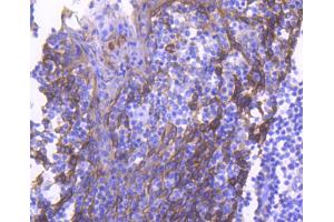 Paraformaldehyde-fixed, paraffin embedded human tonsil, Antigen retrieval by boiling in sodium citrate buffer (pH6) for 15min, Block endogenous peroxidase by 3% hydrogen peroxide for 30 minutes, Blocking buffer at 37°C for 20min, Antibody incubation with Cytokeratin 4 (2F9) Monoclonal Antibody  at 1:50 overnight at 4°C, followed by a conjugated secondary and DAB staining. (KRT4 anticorps)