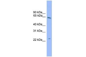 WB Suggested Anti-HSPB8 Antibody Titration: 0. (HSPB8 anticorps  (Middle Region))
