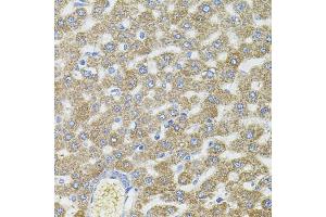 Immunohistochemistry of paraffin-embedded rat liver using CEP164 antibody (ABIN6131021, ABIN6138417, ABIN6138418 and ABIN6225304) (40x lens). (CEP164 anticorps  (AA 730-829))