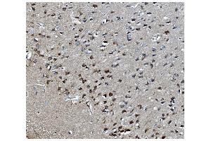 IHC analysis of MAPK1 using anti-MAPK1 antibody (ABIN7600772).