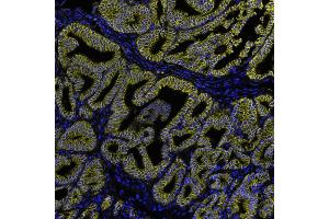 Immunofluorescence (IF) image for anti-Catenin, beta (CATNB) (AA 725-775) antibody (ABIN7454021)