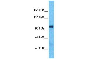 Host:  Rabbit  Target Name:  BOC  Sample Type:  Fetal Lung lysates  Antibody Dilution:  1. (BOC anticorps  (Middle Region))
