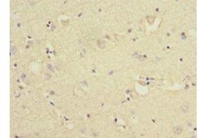 Immunohistochemistry of paraffin-embedded human brain tissue using ABIN7157566 at dilution of 1:100