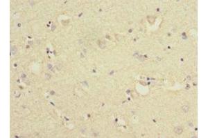 Immunohistochemistry of paraffin-embedded human brain tissue using ABIN7157566 at dilution of 1:100 (KLC1 anticorps  (AA 274-573))