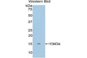 Keratin 2 anticorps  (AA 7-160)