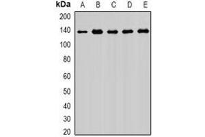 Western blot analysis of Exportin 5 expression in MCF7 (A), HIH3T3 (B), PC12 (C), mouse brain (D), rat brain (E) whole cell lysates.