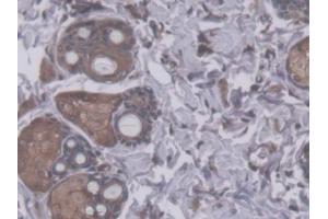 DAB staining on IHC-P; Samples: Rat Skin Tissue (RHAG anticorps  (AA 251-450))