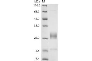 (Tris-Glycine gel) Discontinuous SDS-PAGE (reduced) with 5 % enrichment gel and 15 % separation gel.