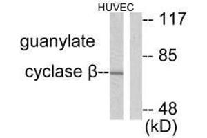 Western blot analysis of extracts from HuvEc cells, using Guanylate Cyclase β antibody. (GUCY1B3 anticorps)