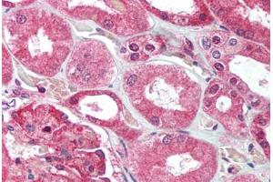 Human Kidney (formalin-fixed, paraffin-embedded) stained with UBE2N antibody ABIN214016 at 2. (UBE2N anticorps  (C-Term))