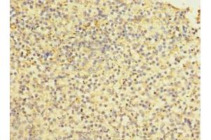 Immunohistochemistry of paraffin-embedded human spleen tissue using ABIN7170685 at dilution of 1:100 (Stabilin 2 (STAB2) (AA 1550-1850) anticorps)