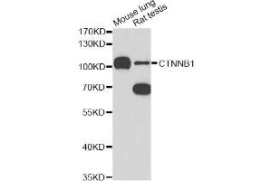 Western blot analysis of extracts of various cell lines, using CTNNB1 antibody (ABIN5997534) at 1/1000 dilution. (CTNNB1 anticorps)