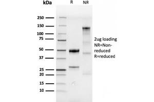 SDS-PAGE Analysis Purified CDX2 Recombinant Rabbit Monoclonal Antibody (CDX2/4394R).