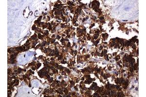 Image no. 15 for anti-Pogo Transposable Element with KRAB Domain (POGK) antibody (ABIN1500329)