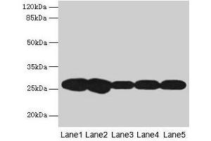 Western blot All lanes: FKBP3 antibody at 4 μg/mL Lane 1: Hela whole cell lysate Lane 2: A431 whole cell lysate Lane 3: PC-3 whole cell lysate Lane 4: Jurkat whole cell lysate Lane 5: 293T whole cell lysate Secondary Goat polyclonal to rabbit IgG at 1/10000 dilution Predicted band size: 26 kDa Observed band size: 26 kDa (FKBP3 anticorps  (AA 2-224))