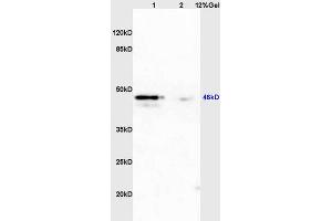 Lane 1: mouse uterus lysates Lane 2: mouse brain lysates probed with Anti PAX2 Polyclonal Antibody, Unconjugated (ABIN738951) at 1:200 in 4 °C.