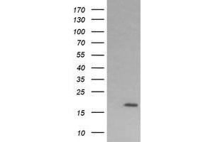 Image no. 2 for anti-Cancer/testis Antigen 1B (CTAG1B) antibody (ABIN1499903) (CTAG1B anticorps)