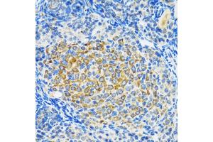 Immunohistochemistry of paraffin-embedded rat ovary using SIRT2 antibody (ABIN3020851, ABIN3020852, ABIN3020853 and ABIN6213756) at dilution of 1:100 (40x lens).