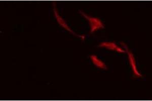 ABIN6275484 staining HeLa cells by IF/ICC. (Repetin anticorps  (C-Term))
